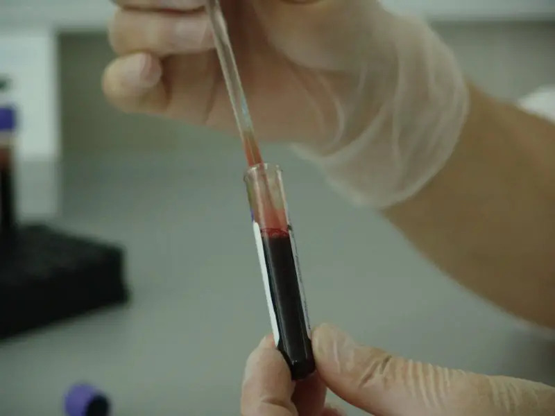 Ile kosztuje ciążowe badanie krwi bez ubezpieczenia? Z 3 pomocnymi testami!