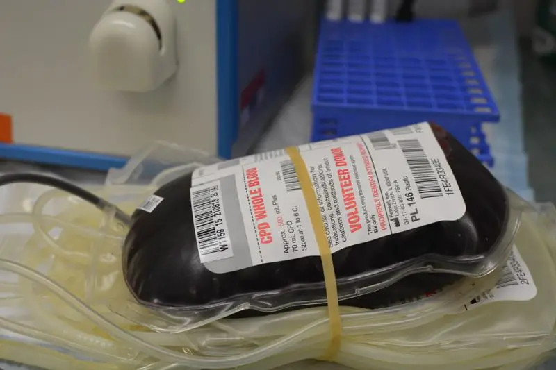 Co to jest autologiczne oddawanie krwi? Jego 3 niesamowite metody!
